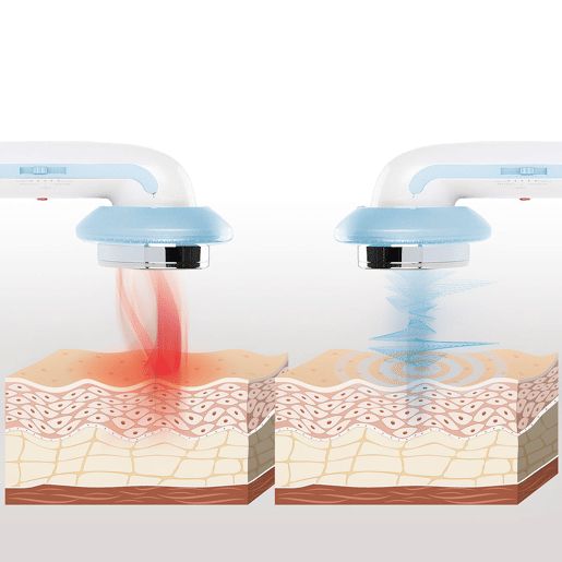 Aparelho de Massagem Anticelulítico por Cavitação Ultrassónica com Infravermelhos e Eletroestimulação 3 em 1 CellyMax InnovaGoods